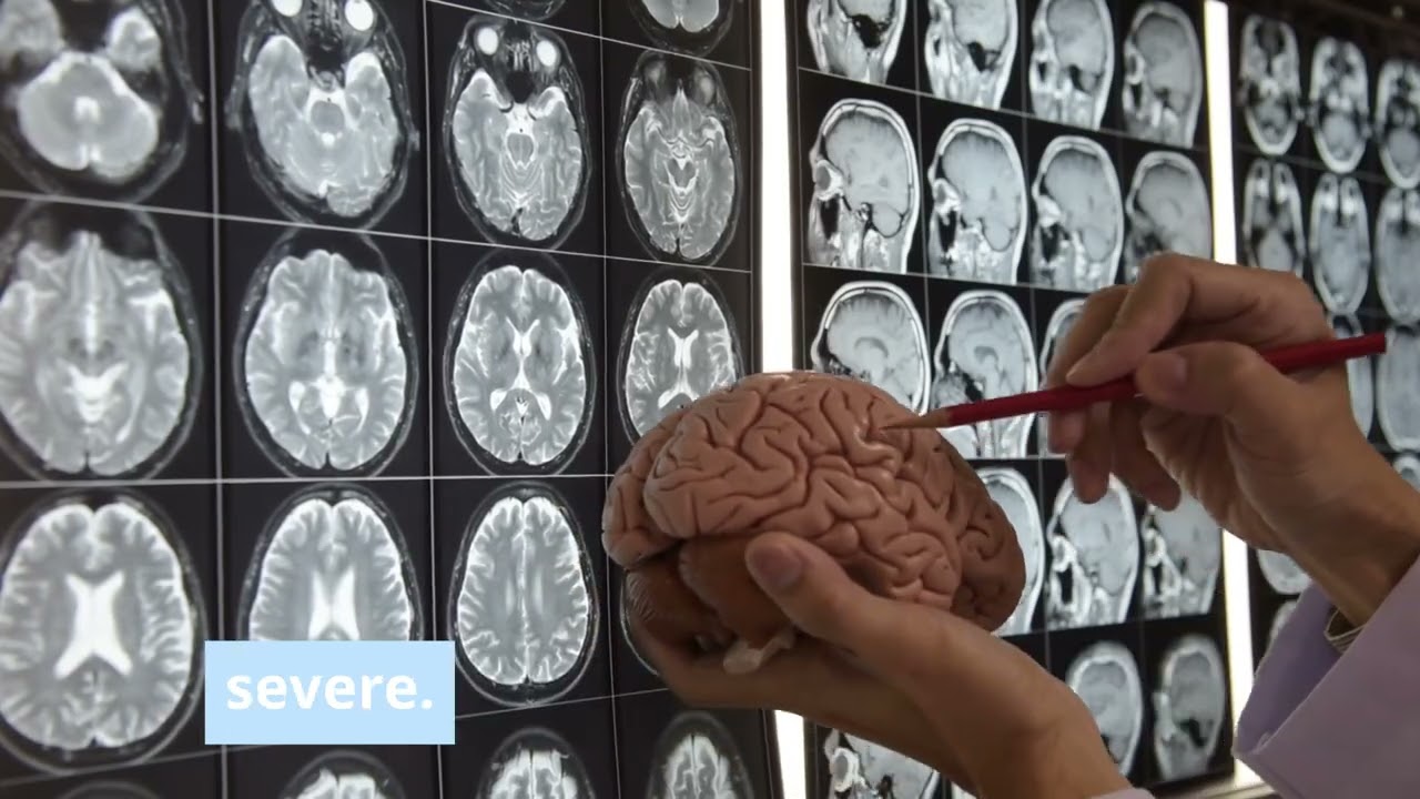 Hypoxic vs Anoxic Brain Injury: How Stem Cell Therapy Helps