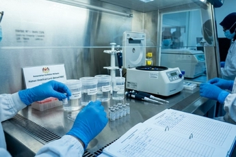 Umbilical cord derived mesenchymal stem cell therapy for rheumatoid arthritis support