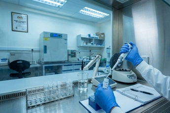 Umbilical cord derived mesenchymal stem cell therapy supporting inflammatory bowel disease