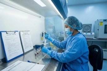 Umbilical cord derived mesenchymal stem cell support for anti aging care