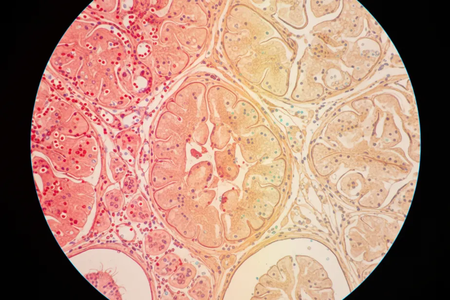 The Future of MSCs in Autoimmune Diseases