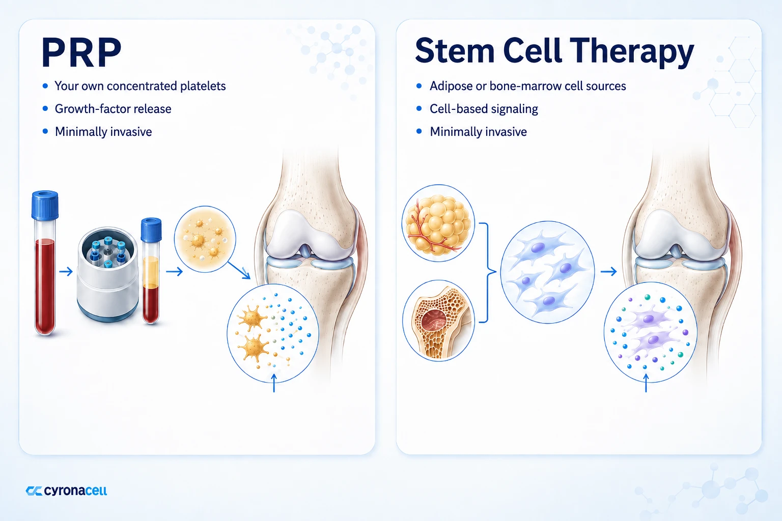 How Stem Cell Therapy Differs From PRP