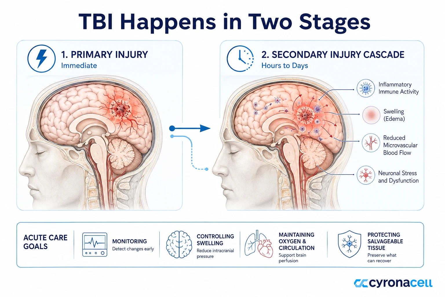 How Traumatic Brain Injury Affects the Brain