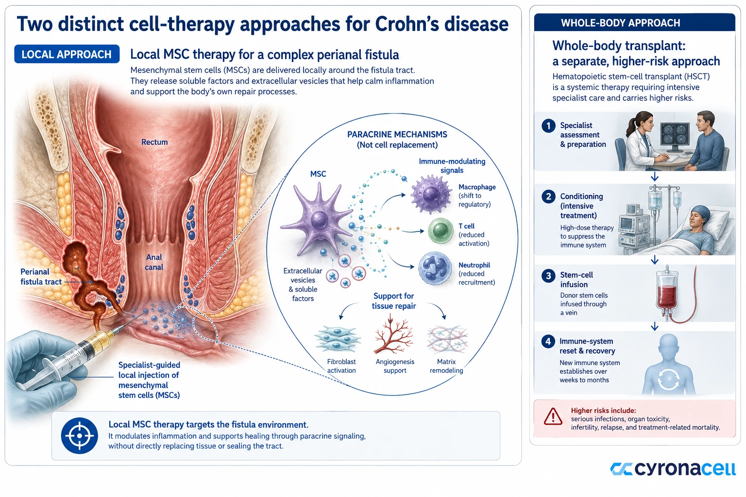 What Is Stem Cell Therapy for Crohn’s Disease