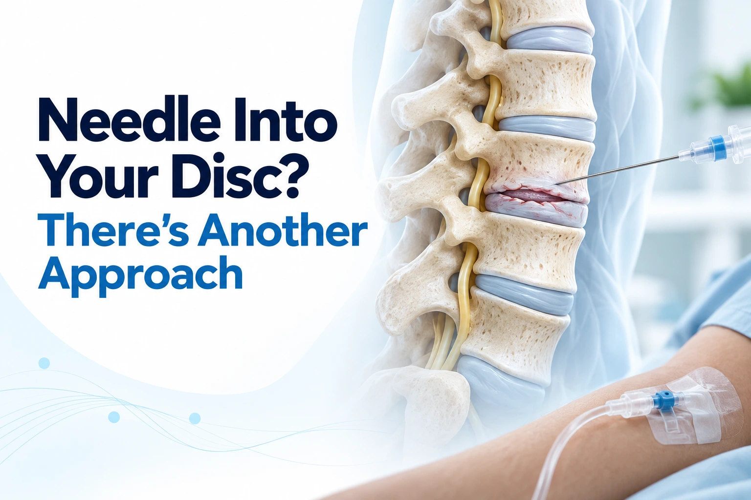 needle-into-your-disc-theres-another-approach