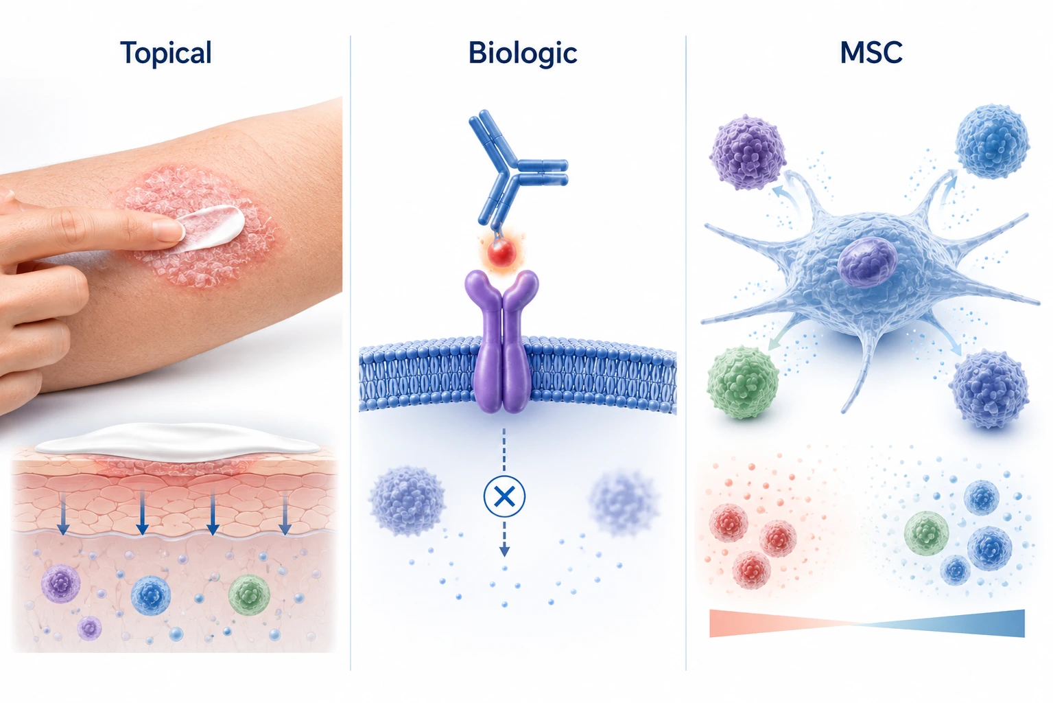 stem-cell-therapy-vs-other-psoriasis-treatments